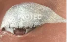 Dark Skin Tone Effect